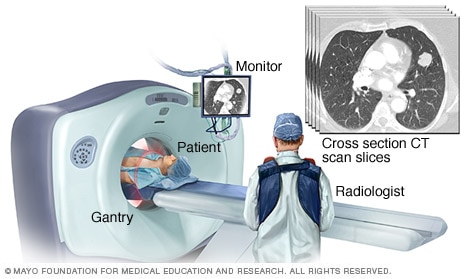 Image showing CT scan slices