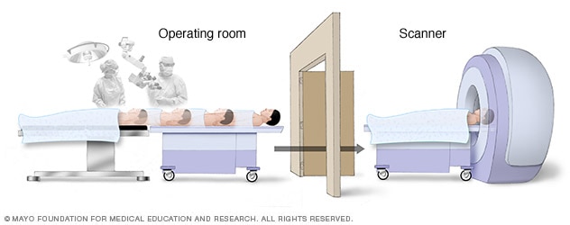 Intraoperative MRI