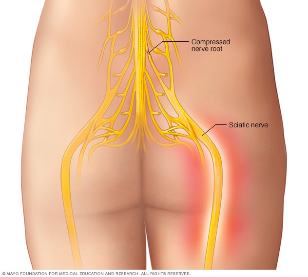 Sciatic nerve 